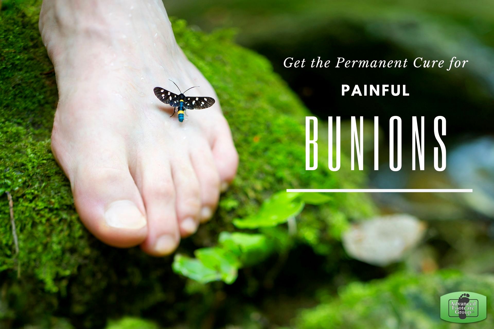 Cure for Painful Bunions 
